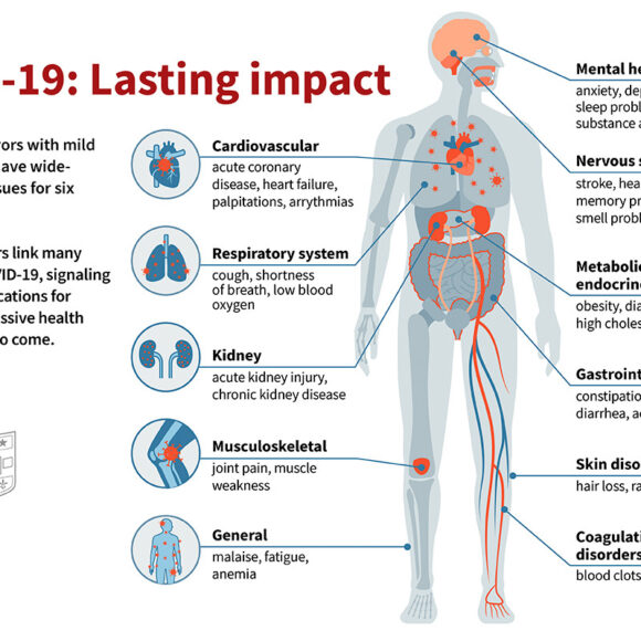 The Unseen Epidemic: Understanding Long COVID and Its Impact on the Body