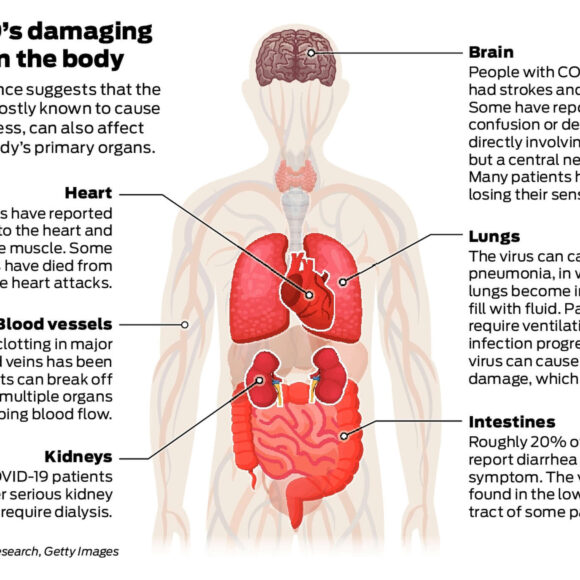 Why COVID-19 Is Nothing Like the Flu – and Why We Should Take It Seriously